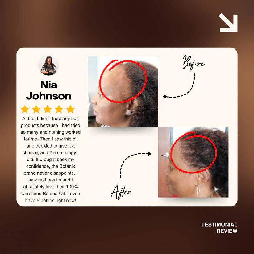 Natural Hair Growth Oil