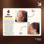 Natural Hair Growth Oil