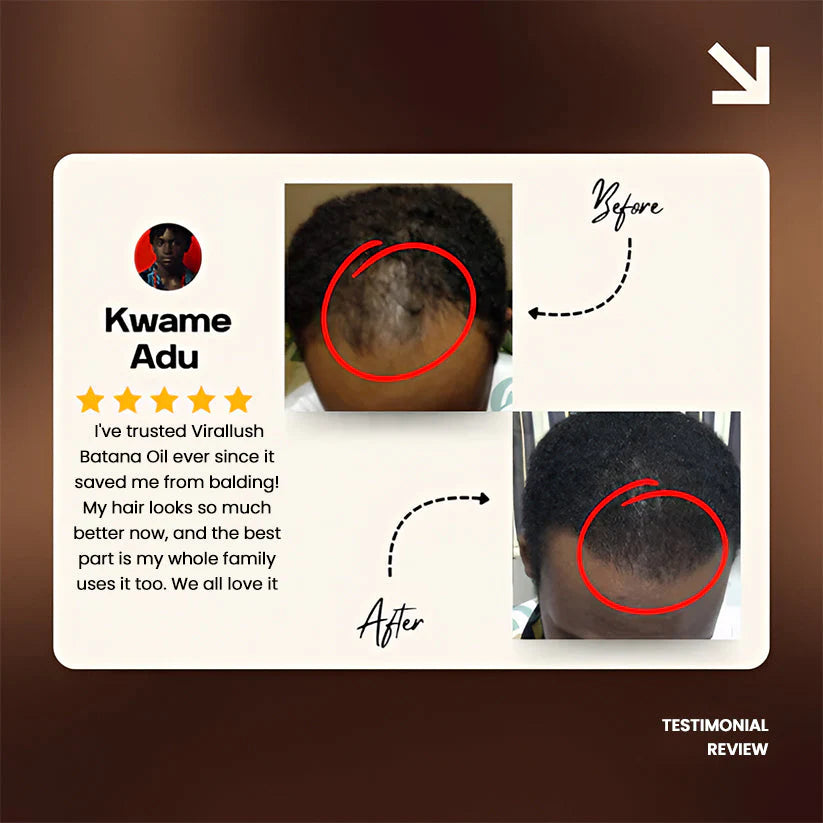 Natural Hair Growth Oil
