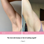 Fast-Acting Hair Removal Cream