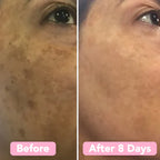 Round skincare cleansing pads infused with turmeric and vitamin C