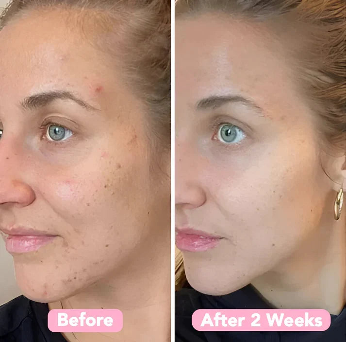 Turmeric cleansing pads for gentle facial cleansing