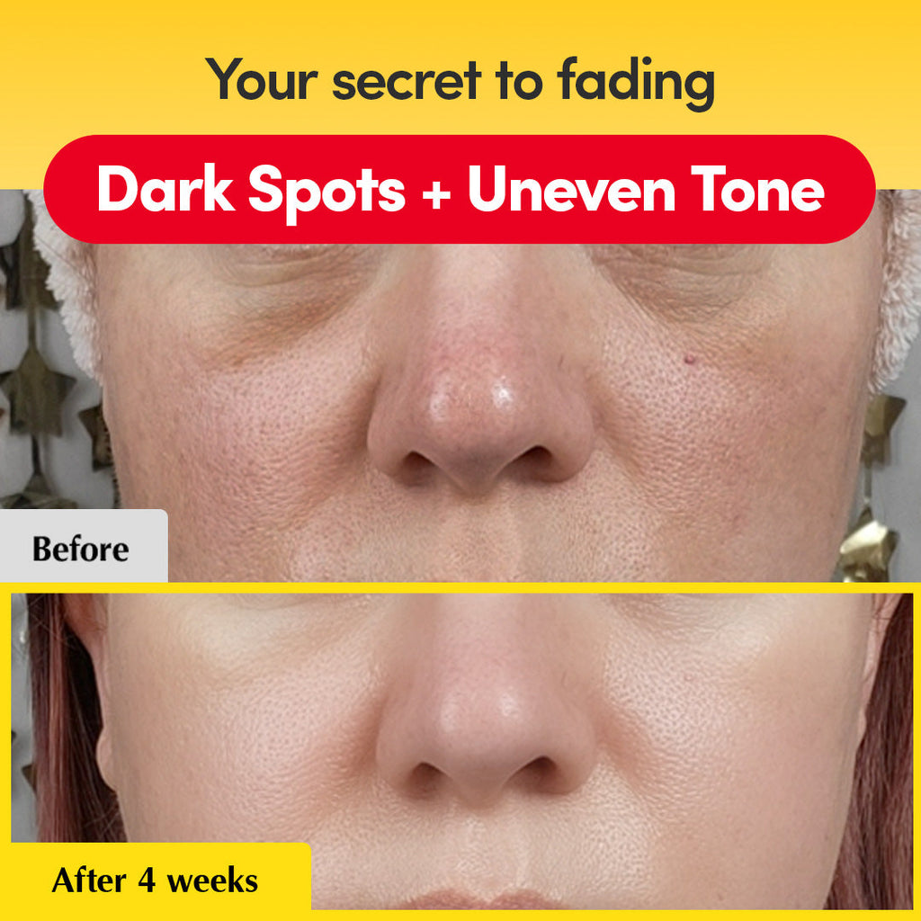 Brightening Vitamin C Serum