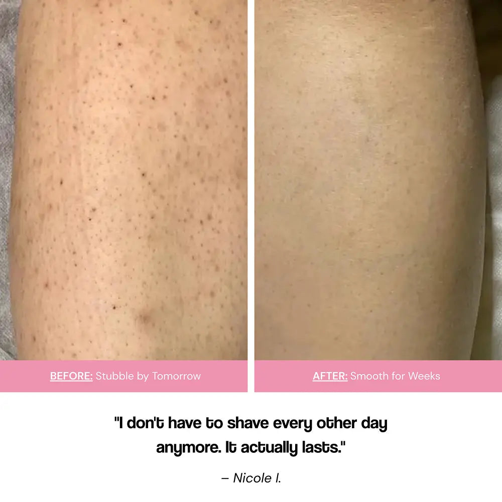 Fast-Acting Hair Removal Cream