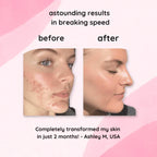 Vitamin C and kojic acid skincare pads product display