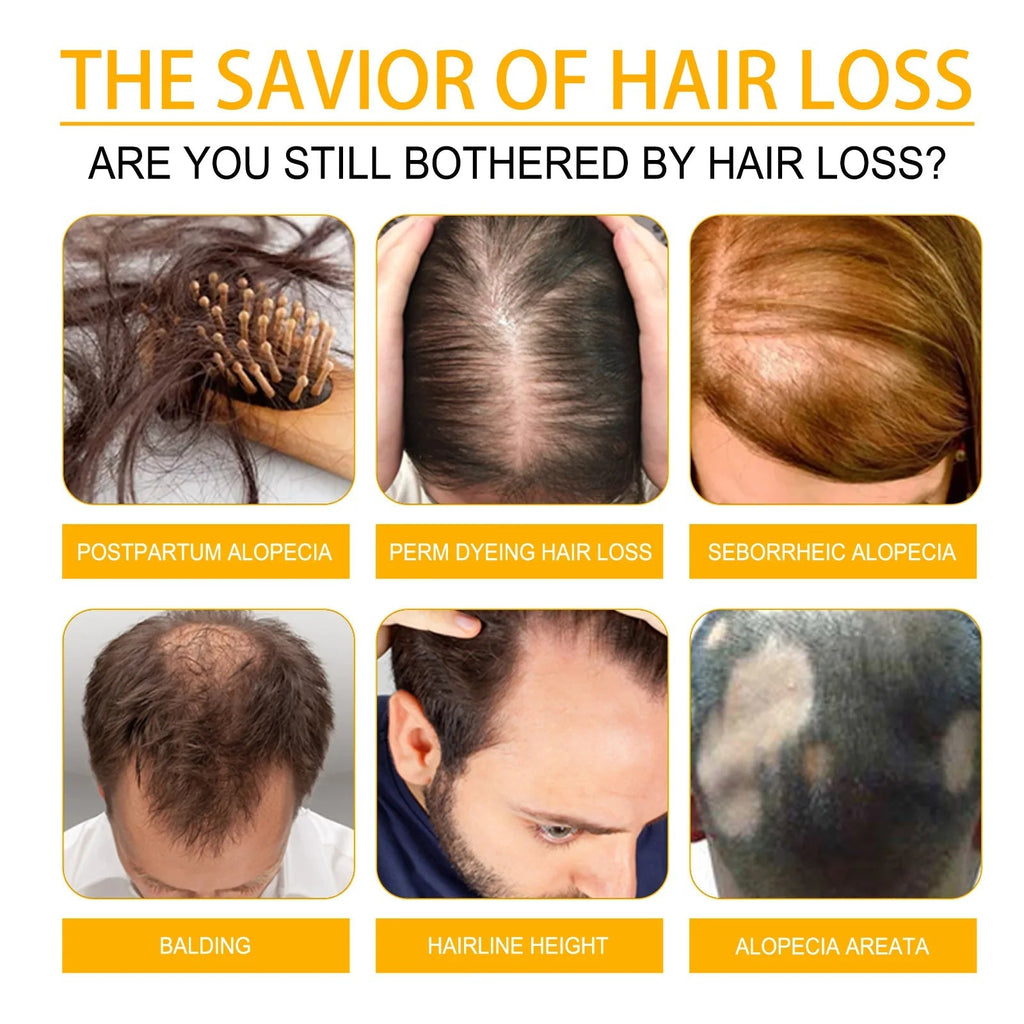 Biotin Scalp Spray Leave In For Thinning Hair 30ml